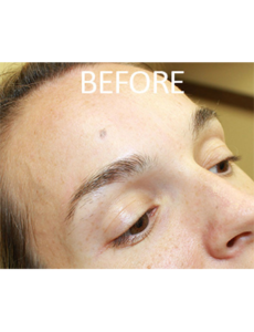 Mardirossian Facial Aesthetics Before and After Pictures